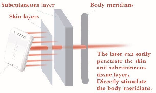 Laser trị liệu bằng đường huyết