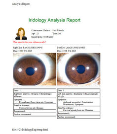 Green Iris Recognition Camera Thiết bị iridology Tiếng Anh Tiếng Tây Ban Nha Trung Quốc