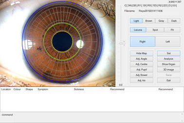 Máy quét Iris cầm tay CE Máy phân tích mắt Iris để phát hiện sức khỏe