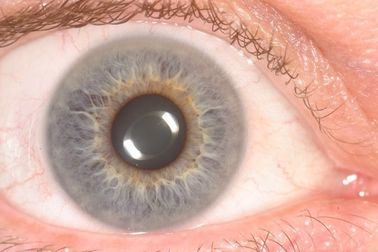 Máy quét Iris cầm tay CE Máy phân tích mắt Iris để phát hiện sức khỏe