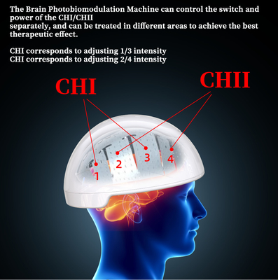 Rtms Trị liệu Não Mũ bảo hiểm Máy kích thích Từ tính Xuyên sọ Điều biến quang cơ
