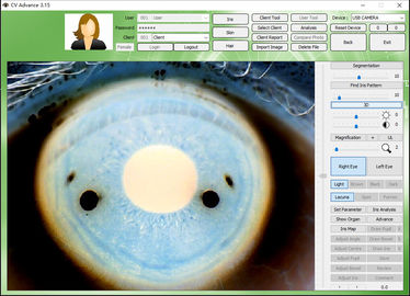 Máy kiểm tra mắt iriscope kỹ thuật số 12.0MP Máy kiểm tra mắt CE / DHL
