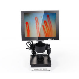 Di động 10 inch LED Hiển thị Nail Fold Capillaroscopy Microcirculation Test Machine