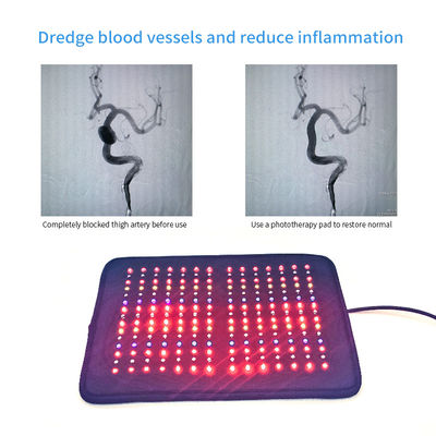 Tấm đệm trị liệu bằng ánh sáng hồng ngoại không nghiêng 20000hz cho vi tuần hoàn máu