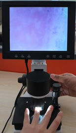 Kính hiển vi màu Nailprint Thiết bị vi tuần hoàn mao quản 380000 pixel với CE