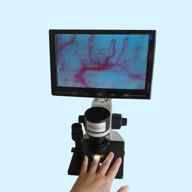 Màn hình LCD Máy kiểm tra vi tuần hoàn màu Bệnh viện lâm sàng Trang chủ