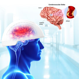Chấn thương sọ não Thiết bị quang hóa não Bước sóng 810nm