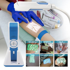 Dụng cụ châm cứu tĩnh mạch phòng khám cầm tay với độ chính xác 0,25mm CE